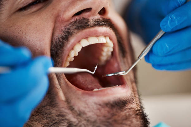 Best Emergency Gum Pain Relief  in Corinth, TX